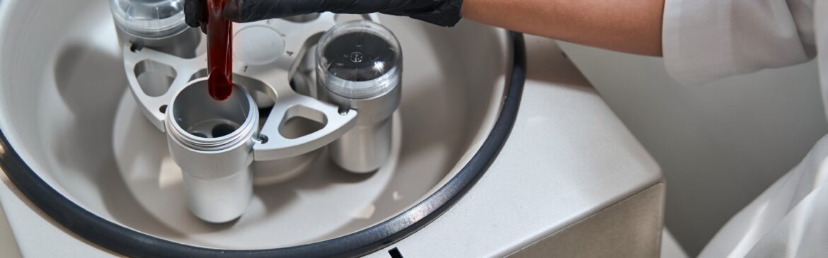 PRP therapy now in Fort Myers, FLorida