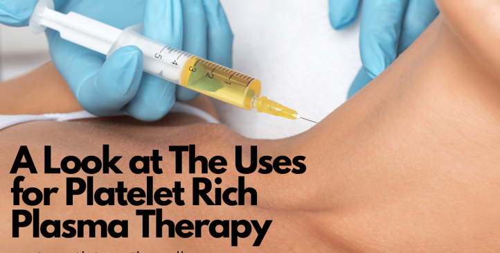PRP therapy fort myers West coast integrative wellness center kaster chiropractic